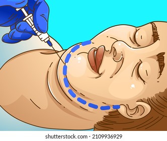 Double chin. The woman with the age problems on her face. Beauty injection. Healthcare illustration. Vector illustration. 