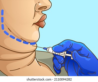 Double chin. The woman with the age problems on her face. Beauty injection. Healthcare illustration. Vector illustration. 