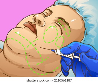 Double chin. The woman with the age problems on her face. Beauty injection. Healthcare illustration. Vector illustration. 