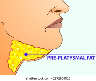 Double chin. The woman with the age problems on her face. Healthcare illustration. Vector illustration. 