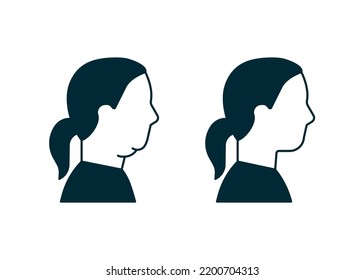 Double chin of woman icon, change in facial aesthetics. Fat loss in overweight on face. Profile girl before and after liposuction, lifting, plastic procedure. Vector silhouette illustration