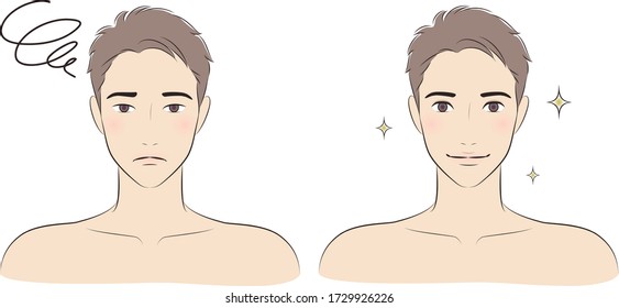 Double eyelid surgery before and after vector illustration for men.