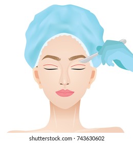 Double Eyelid Surgery Vector Illustration