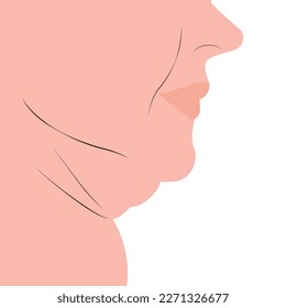 Double fat chin on female face