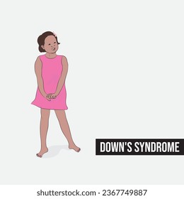 Down syndrome, a genetic disorder caused when abnormal cell division produces extra genetic material from chromosome 21.