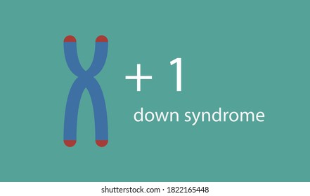 Vector de síndrome de Down. Ilustración En Fondo Azul.