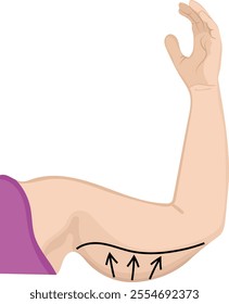Draw Line Excess Fat on Upper Arm Illustration Isolated on White Background
