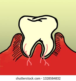 Drawing of a big tooth rooted to the gum. Vector illustration.