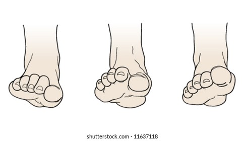 Drawing foot