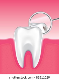 Drawing of the gums and tooth enamel