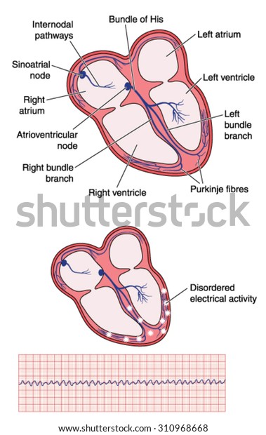 Drawing Heart Electrical Conducting System Site Stock Vector (Royalty ...