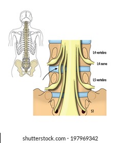 Drawing Of The Lumbar And Sacral Nerves -- Labelled