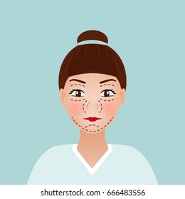 Drawing perforation lines on young pretty woman's face for plastic surgery. vector illustration. medical face lift anti-aging concept.