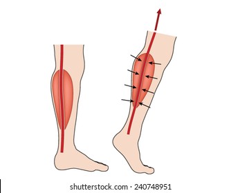 Drawing to show blood forced up from legs due to calf muscle pump. Created in Adobe Illustrator.  EPS 10.