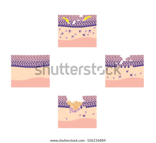 Drawing Show Phases Tissue Repair Specifically Stock Vector (Royalty ...