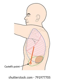 normal and enlarged spleen