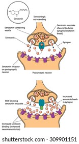 Drawing of a synapse showing serotonin reuptake and the action of an SSRI to block serotonin reuptake