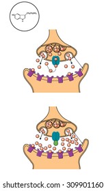 Drawing of a synapse showing serotonin reuptake and the action of an SSRI to block serotonin reuptake