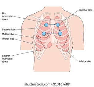 Drawing of the thorax showing the anterior lung position and sites for a stethoscope for lung auscultation