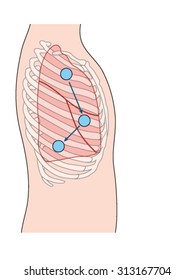 Drawing of the thorax showing the lateral lung position and sites for a stethoscope for lung auscultation