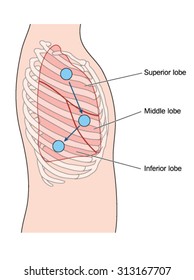 Drawing of the thorax showing the lateral lung position and sites for a stethoscope for lung auscultation