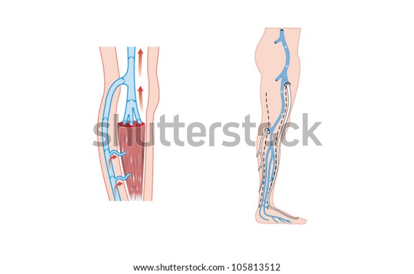 Drawing Veins Leg Calf Muscle Pump Stock Vector Royalty Free 105813512 Are you searching for vein png images or vector? https www shutterstock com image vector drawing veins leg calf muscle pump 105813512