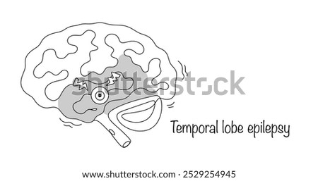 Drawn brain with the temporal lobe highlighted. Temporal lobe epilepsy. A form of epilepsy characterized by seizures with localization of the epileptogenic focus in the temporal lobe of the brain.