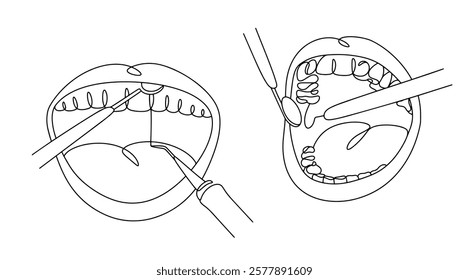 Drawn open mouth of a patient during a dental examination. Examination of the patient's teeth and gums using a dental mirror and probe. Vector illustration for use in the medical field.