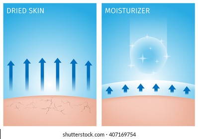 dried   moisturizer skin and   before   after   vector