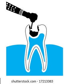 Drilling Tooth