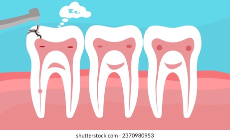 drilling tooth, drilling a tooth, scene of a sleeping tooth and removing caries using a dental drill, A vector stock illustration