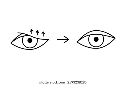 Drooping eyelid with correction, blepharoplasty line icon. Aesthetic plastic surgery of eye. Lift eyelid. Surgical facial rejuvenation. Vector illustration
