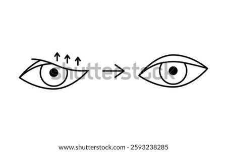 Drooping eyelid with correction, blepharoplasty line icon. Aesthetic plastic surgery of eye. Lift eyelid. Surgical facial rejuvenation. Vector illustration