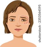 Droopy eyelids compared to normal eyelids. Plastic surgery concept.