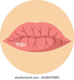 
Dry and Cracked Lips Vector Concept Illustration. Cosmetic problem of dryness and dehydration of the mouth 