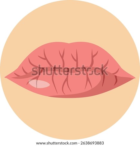 
Dry and Cracked Lips Vector Concept Illustration. Cosmetic problem of dryness and dehydration of the mouth 