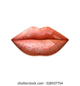  Dry Cracked Woman Lips In A Classic Shape Realistic Isolated Vector Illustration 