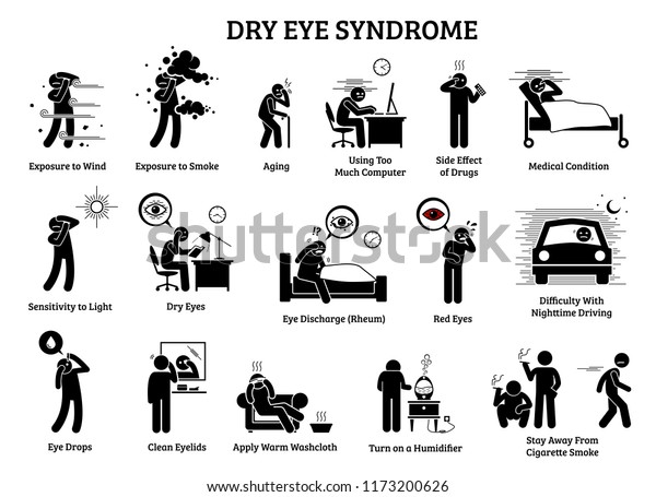 ドライアイ症候群 アイコンのイラストは ドライアイの健康問題の症状 原因 効果 およびホームメディアを示しています のベクター画像素材 ロイヤリティフリー