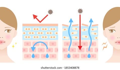 trockene und gesunde Hautschicht und weibliche Illustration. Beauty- und Hautpflegekonzept