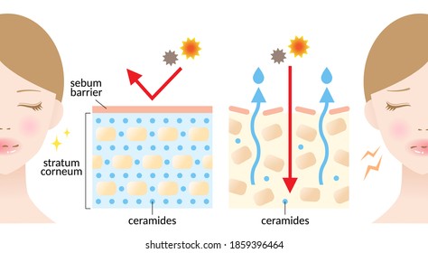 dry and hydrated skin layer with ceramide and woman illustration. beauty and skin care concept