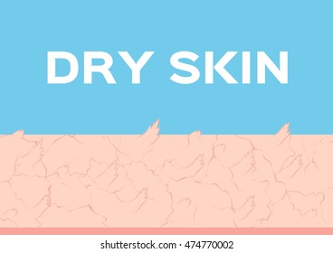 Dry and Nice skin texture , vector