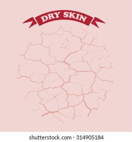 Dry Skin