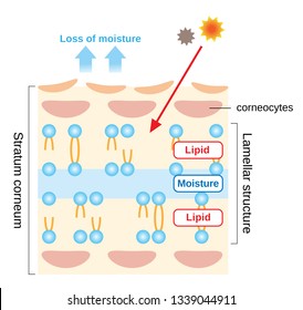 dry skin diagram infographic illustration. structure of stratum corneum and lamellar structure, which play the protective role for skin barrier functions. beauty and skin care concept
