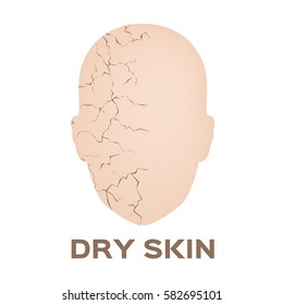 Dry Skin Face Icon And Vector