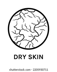 Dry Skin. Icon. Skin Problem. Close up of Dehydrated Unhealthy Skin. Flat Black White color. White background. Vector illustration for Beauty Cosmetic Design.