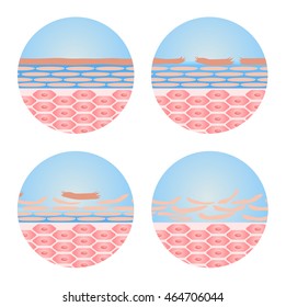 Dry Skin Icon Vector . It Need Moisturizer . Anatomy