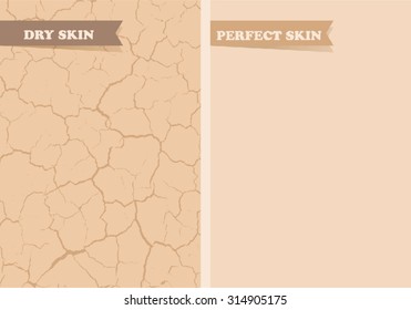 Dry Skin, Perfect Skin