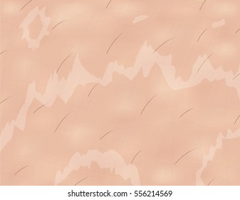 Dry skin texture , vector 