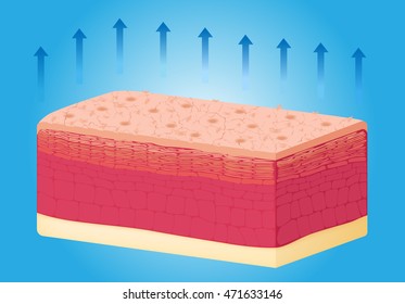 Dry skin  texture , vector , anatomy