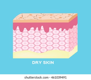 Dry skin texture , vector , icon